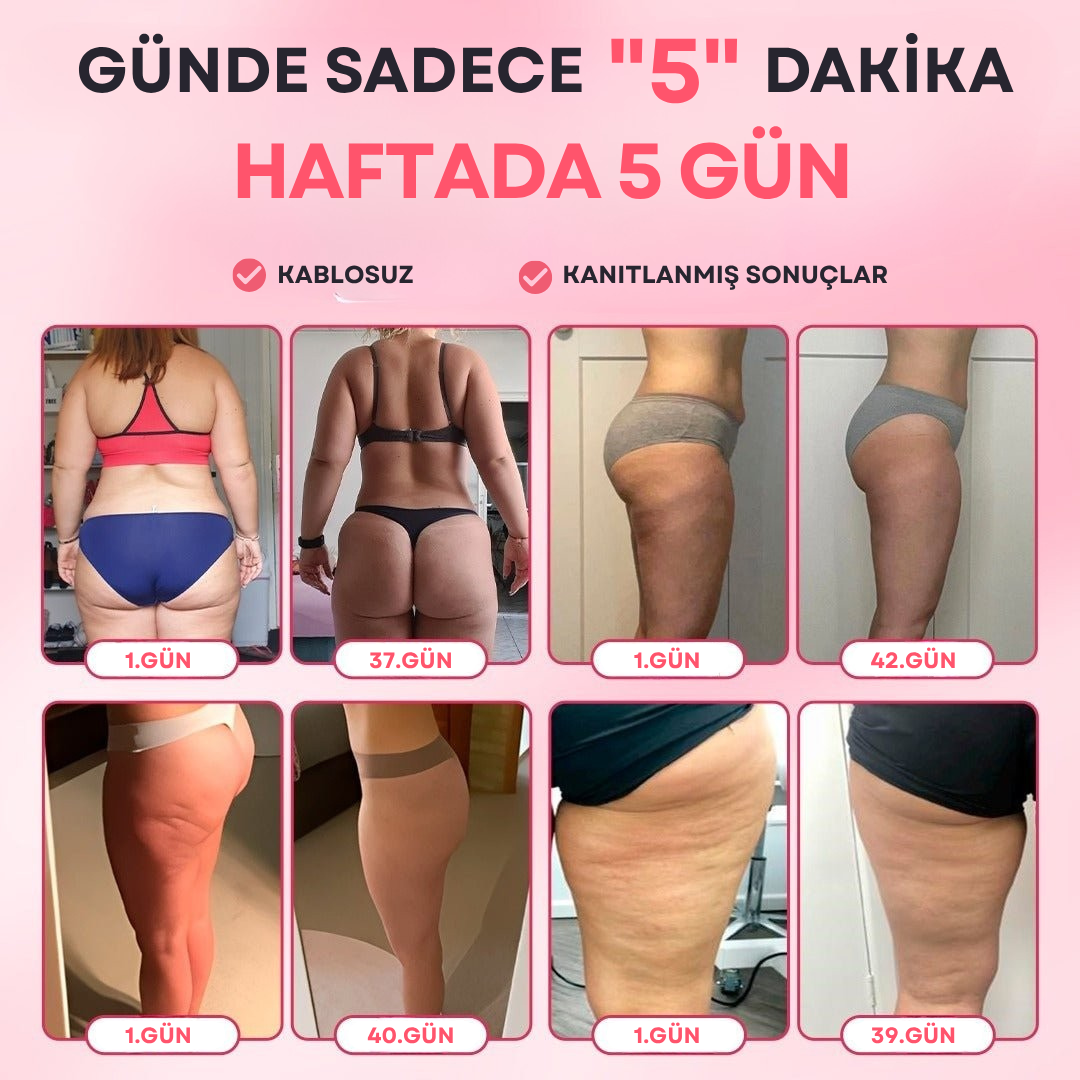 SheVitality Selülit Masaj Aleti